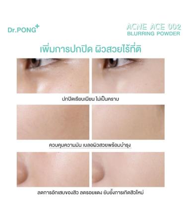 Generic Dr.PONG ACNE ACE 002 - ZincPCA - Niacinamide - Tranexamic acid - Tea Tree oil 9g (Medium 9 g) 0.31 Ounce (Pack of 1) Medium - Buy Online on GoSupps.com