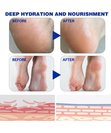 Fengyang Urea Foot Care Cream Foot Balm Stick Urea Foot Balm Stick makes the skin soft for elbows knees feet and hands - Buy Online on GoSupps.com