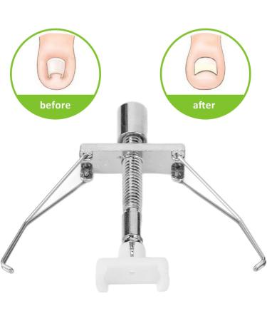 Ingrown Toenail Lifter Tool Set Reduce Pain Swelling Stainless Steel Paronychia Corrector Kit with Stainless Steel - Buy Online on GoSupps.com