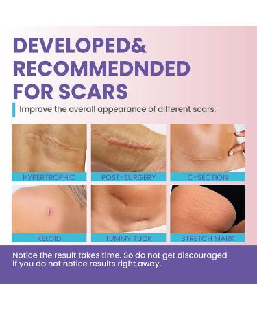 Silicone Scar Sheets for Keloid, C-Section, Tummy Tuck - Surgical Scar Treatment Gel Bandage - Buy Online on GoSupps.com