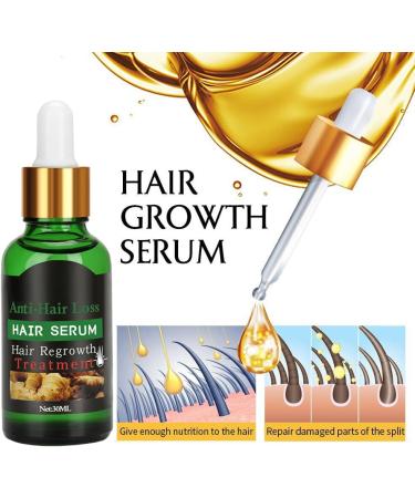Dermaroller Set de micro-aiguilles professionnelles en titane avec 1 jeu de s rum de croissance des cheveux anti-chute de cheveux 1 jeu d'aiguilles professionnelles en titane de 0 5 mm 30 ml (Lot de 1) - Buy Online on GoSupps.com