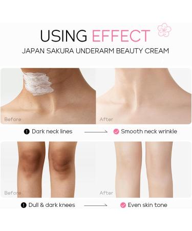 Underarm Whitening Cream Sakura Underarm Whitening Products Skin Lightening Cream Armpit Whitening Cream Boost Collagen Skin Whitening Cream Lightening Cream For Armpit Knees Elbows Legs - Buy Online on GoSupps.com