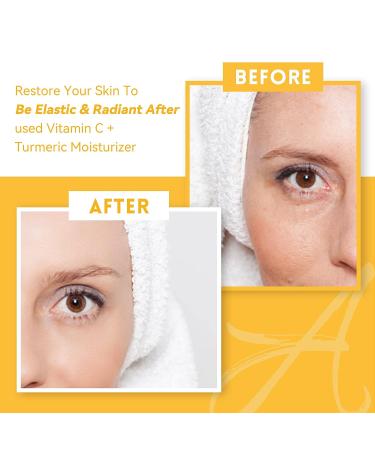 ANAiRUi Turmeric Face Cream with Vitamin C - Dark Spot & Wrinkle Moisturizer 1.76 oz - Buy Online on GoSupps.com