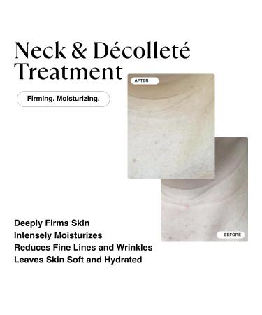 MATKAS Korean Retinol Neck Firming Cream - Tighten & Firm Dehydrated Skin with 8 Peptides Shea Butter & 5 Ceramides for Youthful Neck - Buy Online on GoSupps.com