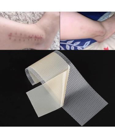 Silicone Scar Sheets 1.6 x 120 Tape Roll | Keloid & Surgical Scar Treatment | Tummy Tucks, C-Section, Burn, Acne, Stretch Marks | Wound Bandages - Buy Online on GoSupps.com