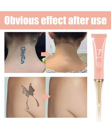 Tattoo Removal Cream - Fast-Acting & Painless Permanent Solution for Skin Pigment Erasing with Rapid Absorption - No Scars - Buy Online on GoSupps.com