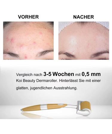 Koi Beauty Dermaroller - 192 Real 1mm Needles for Hair & Beard Growth | Professional Microneedling at Home | Derma Scooter for Scalp & Body - Buy Online on GoSupps.com