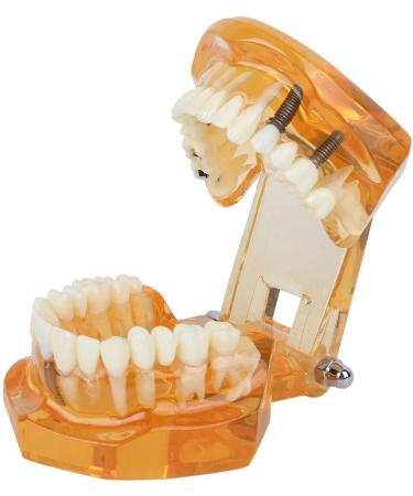 Dpofirs Orange Dental Model - Removable Teaching Tool for Dental Programs Adult Tooth Demonstration & Dental Implants - Buy Online on GoSupps.com