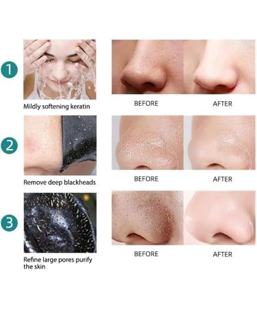 10 PCS Blackhead Nose Remover Strips | Packed in Seal Bag | Nose Beauty Stickers | Unisex Blackhead Acne Removal Deep Pore Cleansing Nose Strips | Black Strips - Buy Online on GoSupps.com