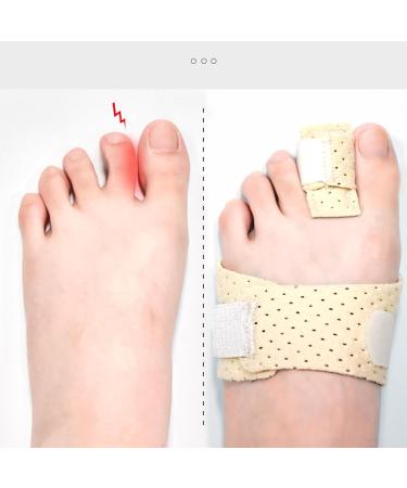 Adjustable Hammer Toe Corrector with Aluminum Bar - Recovery & Alignment Support - Buy Online on GoSupps.com