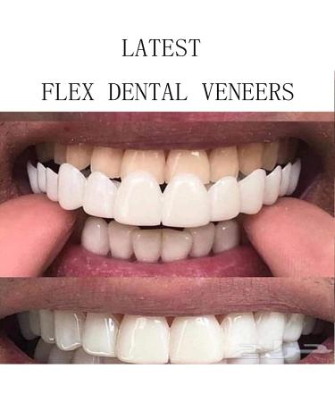 Giural 2 Pairs Extra Thin Teeth Veneers - Comfort Fit Dental Prosthesis for Men & Women | Safe Provisional Dentures for a Beautiful Smile - Buy Online on GoSupps.com