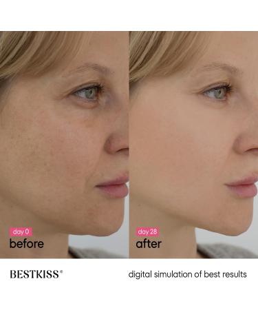 Bestkiss Dark Spot Remover for Face: Dark Spot Corrector Serum - 10% Niacinamide 5% Tranexamic Acid 2% Alpha-Arbutin Ceramides Hyaluronic Acid Centella Asiatica - Fragrance Cruelty Free Vegan 30mL Pink - Buy Online on GoSupps.com