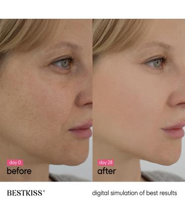 Bestkiss 10% Niacinamide 5% Tranexamic Acid 2% Alpha-Arbutin Dark Spot Serum with Ceramides Hyaluronic Acid Centella & Asiatica - Vegan Paraben Fragrance Cruelty Free 1 FL OZ - Buy Online on GoSupps.com