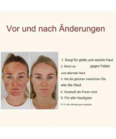 Baume hydratant pour le visage | Baume pour le visage pour hydrater la peau cr me de jour douce apporte un soin apaisant pour femmes hommes adultes famille amis - Buy Online on GoSupps.com
