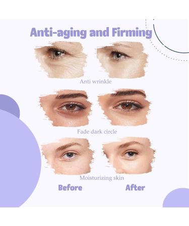 Retinol Serum Roller - Eye Bags Remover - Eye Serum Anti Aging Fade Lines - Eye Cream for Dark Circles and Puffy Eyes - Anti Wrinkle Eye Cream - Moisturing and Leaving Skin Smooth - Buy Online on GoSupps.com