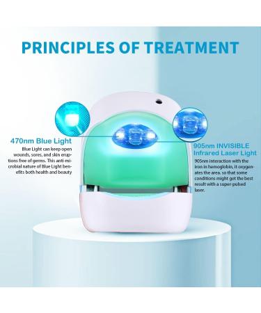 Nails Fungus Treatment Device VENDELLA Rechargeable Nail Fungus Laser Remover Pain-Free and Safe for Onychomycosis Discolored Brittle Cracked Nails and Thickened Toenails and Fingernails - Buy Online on GoSupps.com