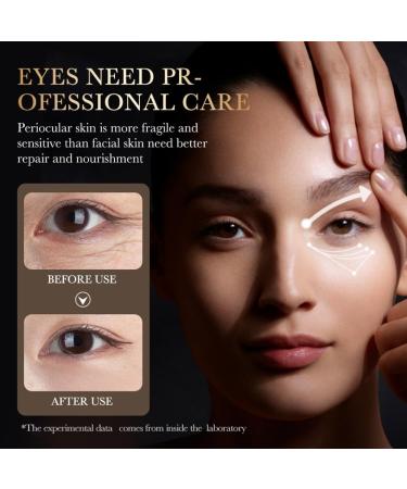 24K Gold Hyaluronic Acid Eye Cream - Anti-Aging Dark Circles & Fine Lines Treatment - 1.4 Oz - Buy Online on GoSupps.com