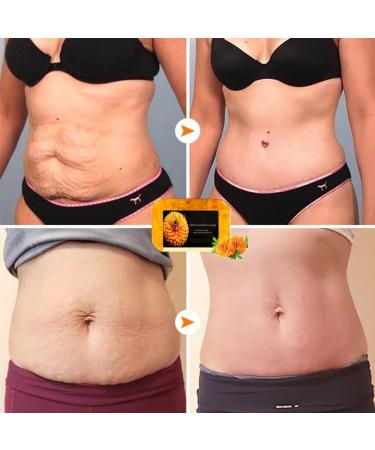 2PCS Anti Cellulite Firming Soap with Ginger - Organic & Natural Ingredients for All Skin Types - Buy Online on GoSupps.com