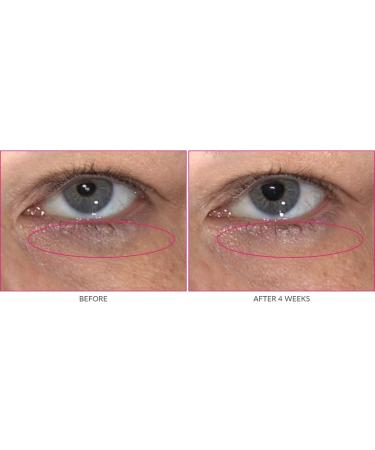 KATE SOMERVILLE Wrinkle Warrior Eye Gel Visible Dark Circle Eraser - Buy Online on GoSupps.com