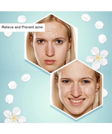 Zone 365 Retinol Serum for Face | Anti Aging Serum with Hyaluronic Acid & Vitamin E | All Skin Types - Buy Online on GoSupps.com