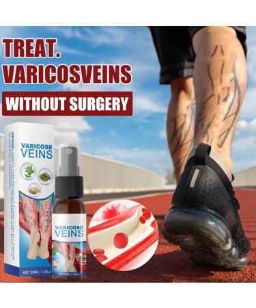 Varicose Veins Cream - Lichengtai Miracle Spray for Varicose & Spider Veins Relief - 3 Pack (20g) - Fast Muscle Soreness Relief - Buy Online on GoSupps.com