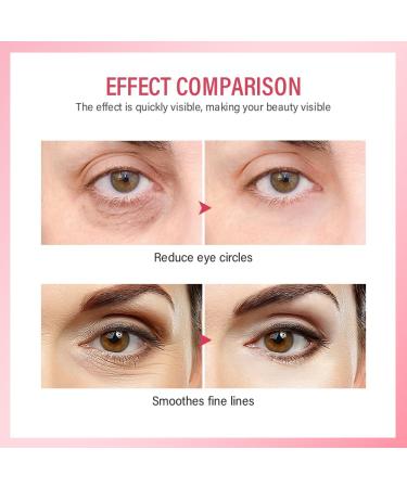 Retinol Eye Cream for Dark Circles & Puffiness - Anti-Aging Under Eye Treatment to Reduce Wrinkles & Fine Lines | Hydrate & Smooth Your Eye Area - Buy Online on GoSupps.com