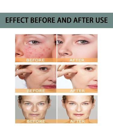 Glycolic Acid 7% Toning Solution - Exfoliate, Brighten, and Rejuvenate Skin | 100ml - Buy Online on GoSupps.com