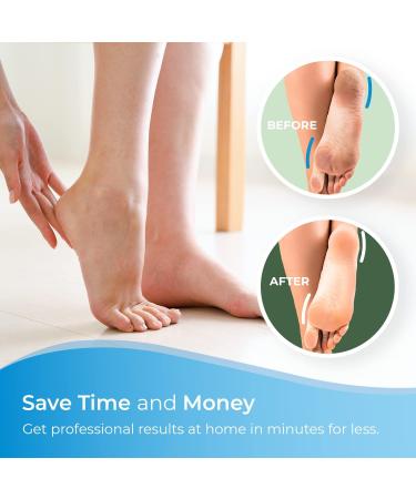 4-Pack Extreme Coarse Green Replacement Rollers for Emjoi Micro Pedi - Buy Online on GoSupps.com