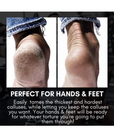 SandBar Callus Remover Tool with Salve - Ultimate Solution for Hands and Feet | Black, 1 Count - Buy Online on GoSupps.com