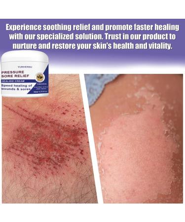 Pressure Sore Relief Healing Cream - Fast Absorption Moisturizing Formula for Wound Healing & Itch Relief | Soothing Redness & Promoting Healthy Skin - Buy Online on GoSupps.com