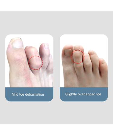 Toe Splint Hammer Straightener - Hammer Toe Corrector & Support for Adults (S Right Foot) - Improve Comfort & Alignment - Buy Online on GoSupps.com