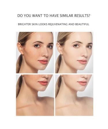 VENZEN Niacinamide Cream - Natural Skin Care for Deep Hydration, Moisturizing Vitamin B3 Formula - 50g - Buy Online on GoSupps.com