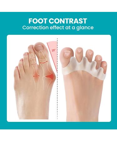 Toe Separators for Bunions - Promifun 8 Pack Toe Spacers for Men & Women | Correct & Restore Toes | Perfect for Running & Yoga (X-Large White - Buy Online on GoSupps.com