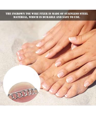 12 * Toenail Correction WireToenail Correction Wire Ingrown Toe Pedicure Tool Stainless Steel Toe Nail Recovery Corrector 12PCS - Buy Online on GoSupps.com
