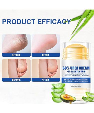 Cr me pour les Pieds Secs et Fissur s 40g Cr me Pieds R paratrice Hydratante Hydratante et Nourrissante Soin R parateur Anti-Fissures pour Pieds Tr s Secs et Ab m s avec Aloe Vera - Buy Online on GoSupps.com