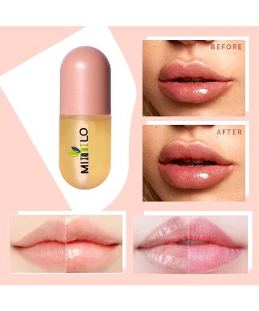 M/N /N Lip Kit Moisturizing Lip Plumper Kit for Day and Night Use - Lip Plumping Gloss Natural Lip Plumper Oil Serum Essence Moisturizer - Buy Online on GoSupps.com