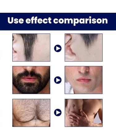 Anshka Men Permanent Hair Beard Removal Cream Hair Removal Paste Face Hair Removal Spray Foam for Men Hair Removal Cream Suitable for All Skin Types 2 pieces - Buy Online on GoSupps.com
