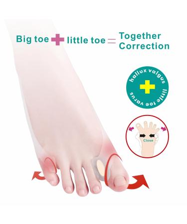 Adjustable Toe Separator & Corrector for Women - Large Size 8-10 (2PC) - Ashomie New Generation - Buy Online on GoSupps.com