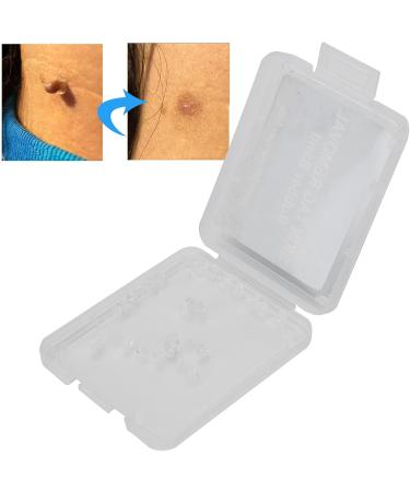 30Pcs Skin Tag Removal Rubber Bands Safe Micro Band Non Toxic Mole Wart Skin Care Tools Facial Care Micro Strip Skin Care Tools for Body Face - Buy Online on GoSupps.com