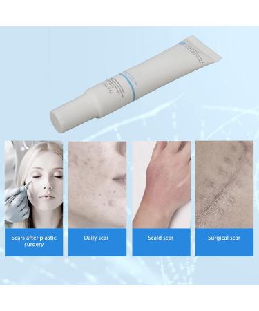 Scar Removal Ointment Gel - Herbal Cream for Old & New Scars, Stretch Marks, Surgery Injuries, Burns & Acne Treatment 1.1oz - Buy Online on GoSupps.com