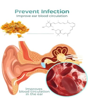 IEXUX Anti Cochlear Blockage Removal Spray - Earwax Removal Drops for Clogged Ears (3PCS) - Buy Online on GoSupps.com