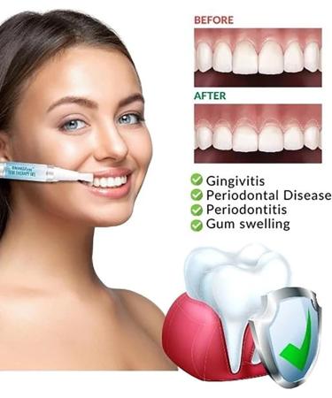Taileden Gel Taileden Gum Therapy Gel Taileden Gum Therapy Gel Taileden Gum Care Gel Gum Shield Therapy Gel Gum Therapy Gel for Recessed Gums Teeth Whitening Essence Pen (1pcs) - Buy Online on GoSupps.com