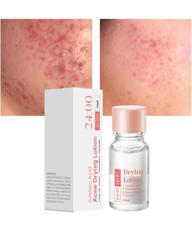  lisutupode Blemish Treatment - 10ml Dry Solution for pimples and moisturizers - Soothing beauty product to prepare makeup - Buy Online on GoSupps.com