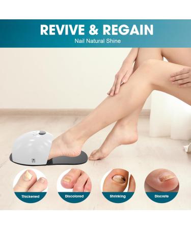 Nail Fungus Light Device - 905nm Infrared & 470nm Blue Light for Toenail & Fingernail Repair | Effective Solution for Damaged & Discolored Nails - Buy Online on GoSupps.com