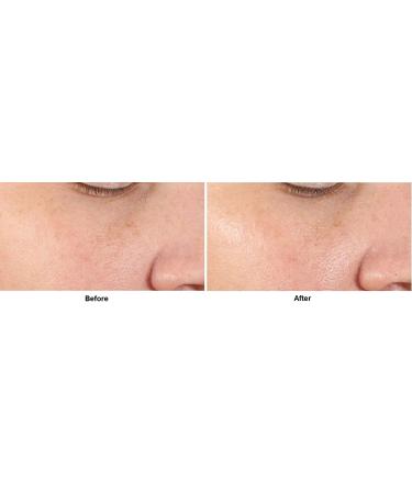 Dr. Dennis Gross Alpha Beta Pore Perfecting Serum - 1.0 fl oz - Buy Online on GoSupps.com