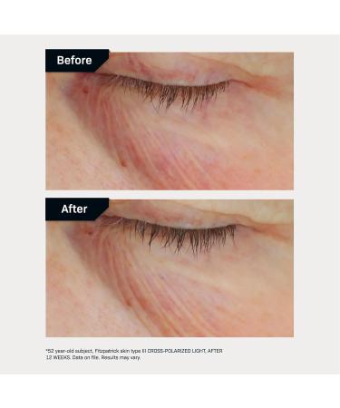 Buy Revision Skincare C+ Brightening Eye Complex - Vitamin C Eye Cream for Dark Circles & Puffiness - 0.5 oz (International Shipping - Buy Online on GoSupps.com