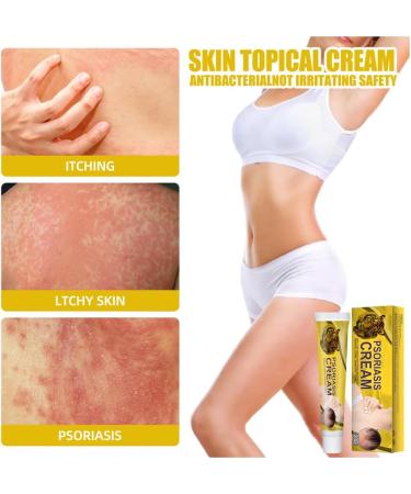 VEJIA Eczema Psoriasis Treatment Cream 20g - Dermatitis Pruritus Relief Ointment for Adults (3pcs) - Buy Online on GoSupps.com