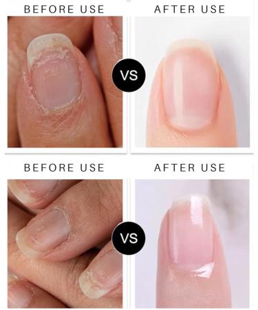 Stylo soin des ongles Soin Fortifiant pour Ongles | Stylo hydratant pour Adultes Femmes Personnes g es Maison Voyage Salon - Buy Online on GoSupps.com