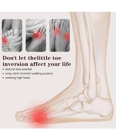 Norhogo Silicone Toe Separator - 4 Pairs for Pinky & Overlapping Toes Relief | Comfortable Toe Spreader for Pain & Pressure Relief - Buy Online on GoSupps.com