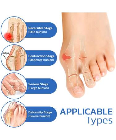 ASSOYEZ AntiBunion and VeinHeal Health Socks - Bunion Relief & Varicose Veins Support (2 Pairs) - Buy Online on GoSupps.com